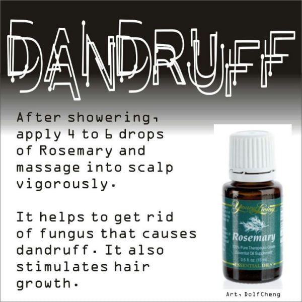 How do you treat dandruff?