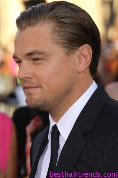 Receding Hairline in Men & Women: Causes, Signs, and Treatment