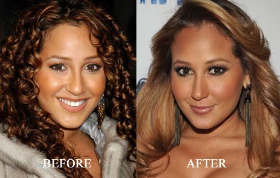 Adrienne Bailon plastic surgery