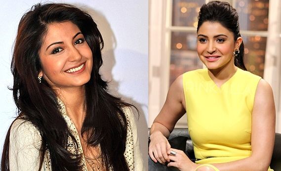 Anushka Sharma plastic surgery before and after