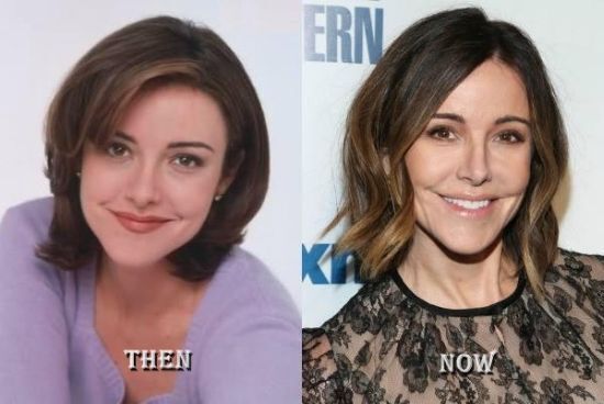 Christa Miller plastic surgery photo