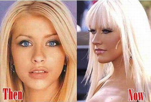 Christina Aguilera neuscorrectie voor en na