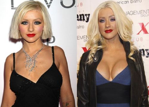 Cristina Aguilera fotografie de chirurgie plastică