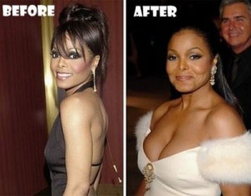 Janet Jackson plastic surgery before and after