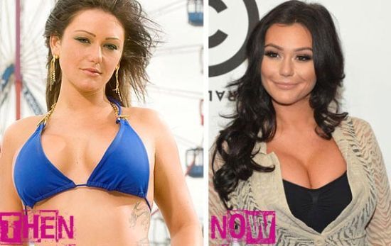 Jwoww plastic surgery photos