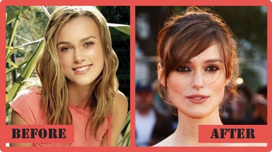 Keira Knightley Plastic Surgery - The Bewildering Story