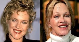 melanie griffith before and after