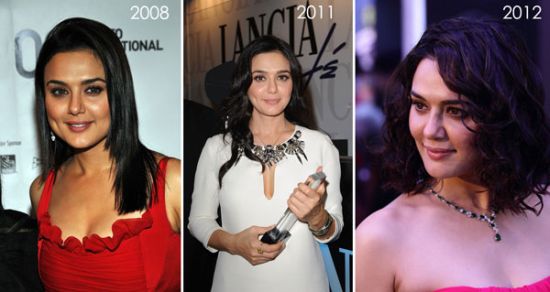 Preity Zinta plastic surgery before and after