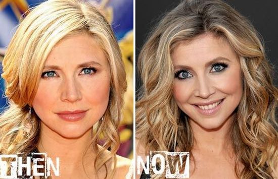 Sarah Chalke plastic surgery before and after