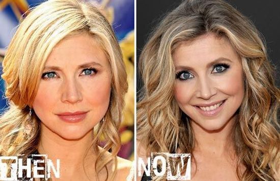 Sarah Chalke plastic surgery before and after