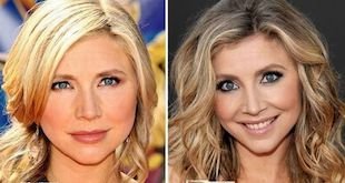 Sarah Chalke Plastic Surgery – The Truth