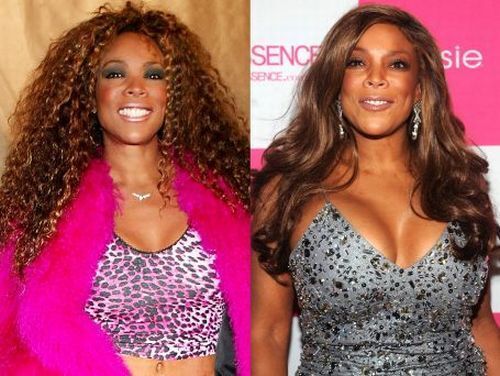 Wendy Williams breast augmentation before and after