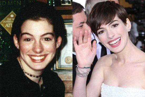 Anne Hathaway then and now