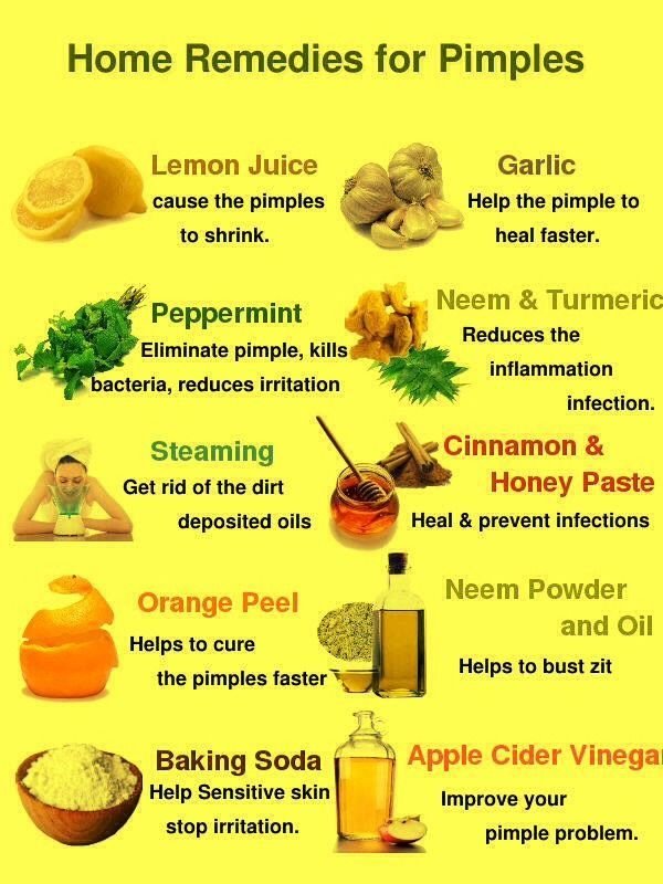 Pimple home remedies