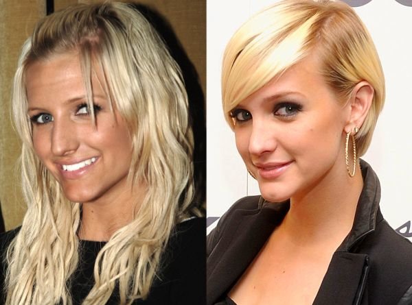 Ashlee Simpson plastic surgery before and after
