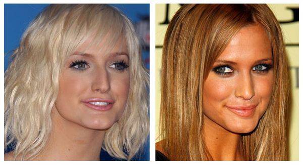 Ashlee Simpson plastic surgery photo