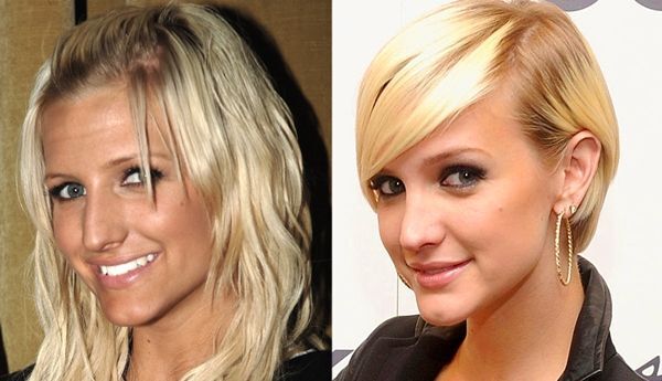 Ashlee Simpson plastic surgery