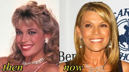 Vanna White plastic surgery photo