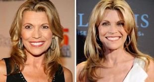 vanna white plastic surgery