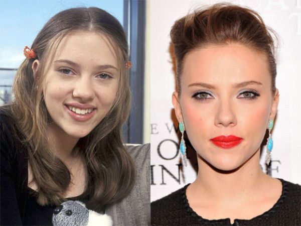 Scarlett Johansson nose job before and after