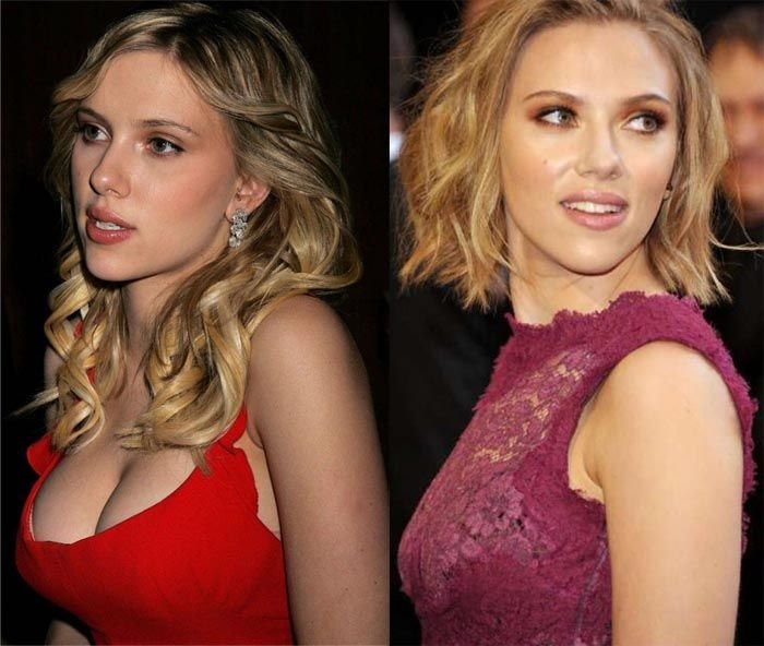 scarlett johansson plastické chirurgie, než po