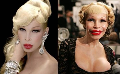 Amanda Lepore plastic surgery photo