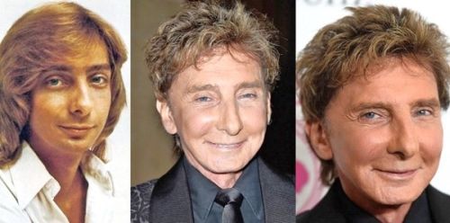 Barry Manilow plastic surgery gone wrong