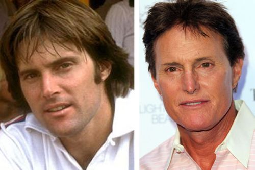 Bruce Jenner plastic surgery before and after