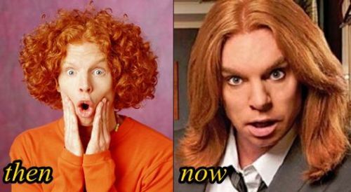 Carrot Top plastic surgery gone wrong