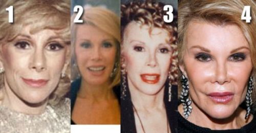 Joan Rivers plastic surgery before and after