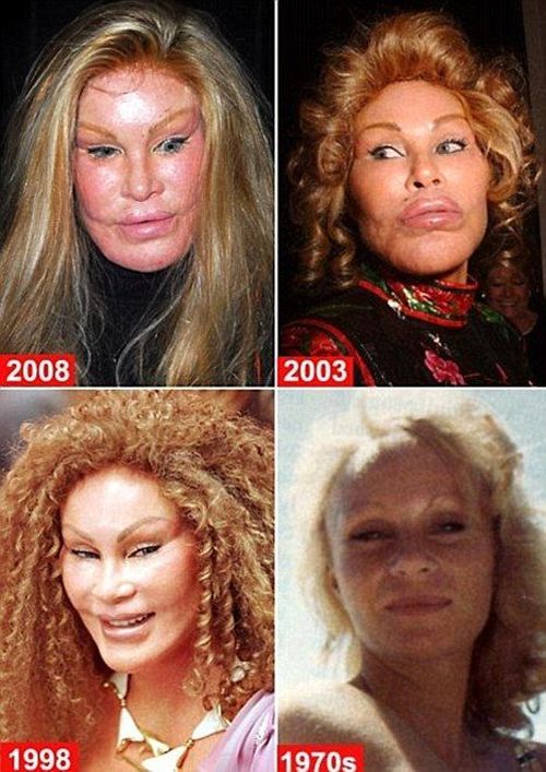 free worst plastic surgery before and after