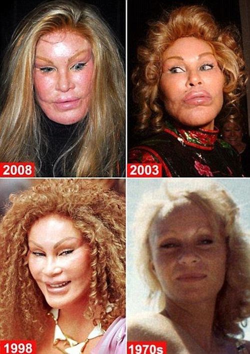 Jocelyn Wildenstein Plastic Surgery Before Photos