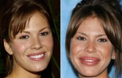 Nikki Cox plastic surgery gone wrong