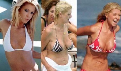 Tara Reid plastic surgery now and then