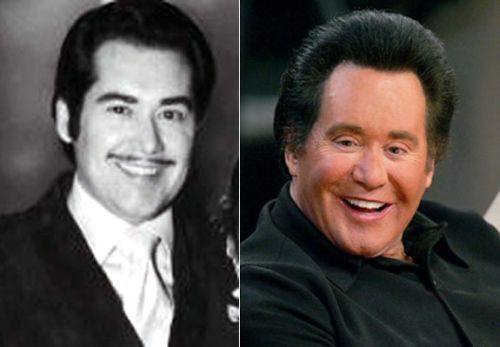 Wayne Newton plastic surgery gone wrong