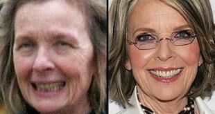 diane keaton before and after