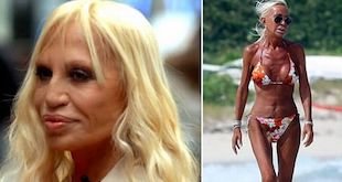 donatella versace before and after