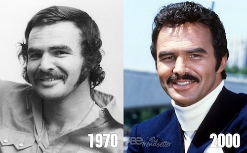 burt reynolds plastic surgery gone wrong