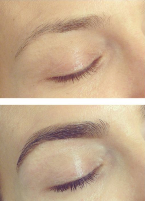 organyc brow serum before and after photos