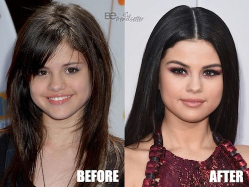 selena gomez nose job before and after