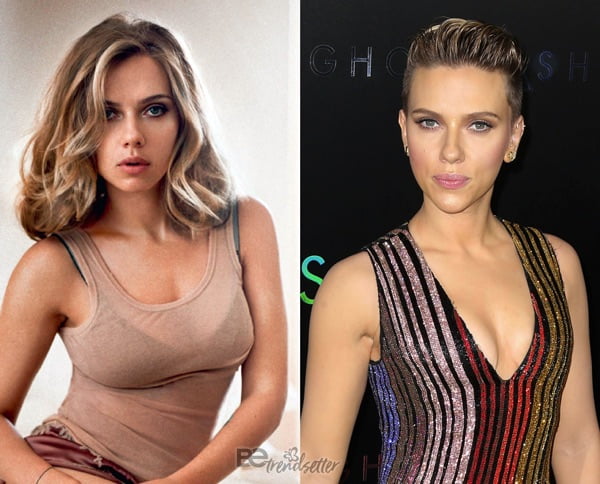 Scarlett Johansson Plastic Surgery Breast Reduction Before After.