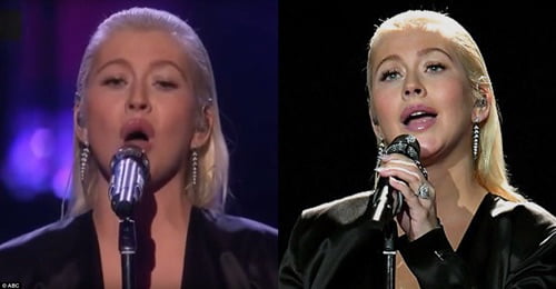 Christina Aguilera Lip Fillers