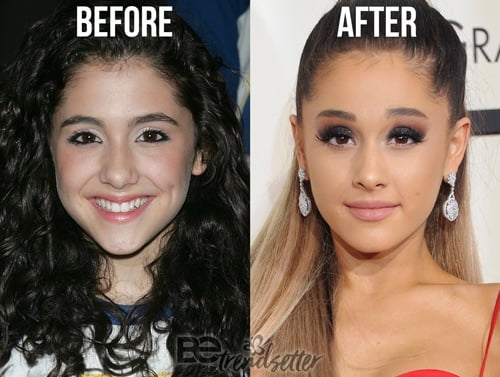 Bilderesultat for ariana grande nose job