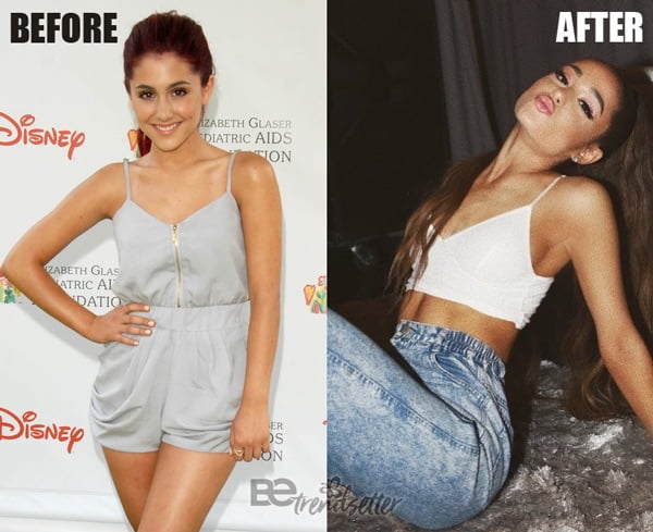 Ariana Grande Plastic Surgery REVEALED! Then And Now