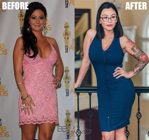 jwoww plastic surgery before and after