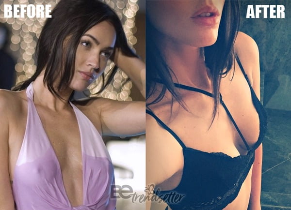 megan fox breast implants before and after