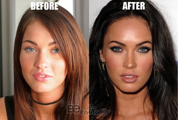 megan fox nose job before and after