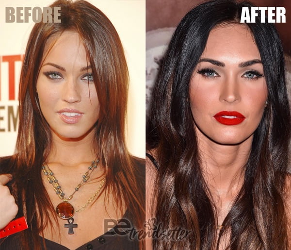 megan fox plastic surgery results