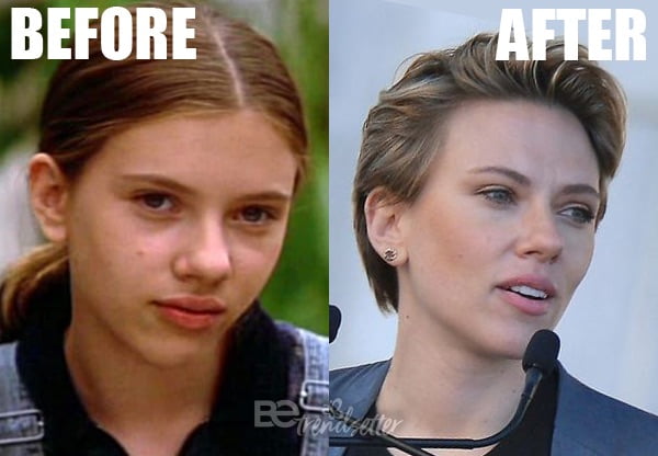  Scarlett Johansson Nase 2018