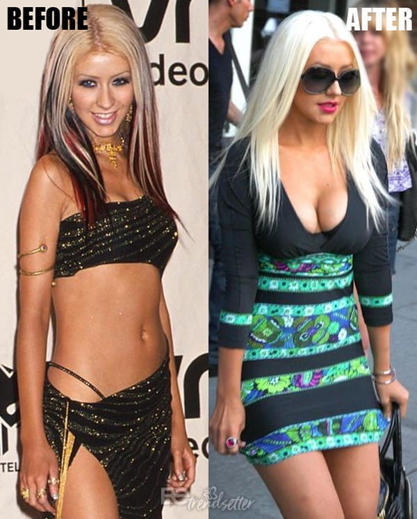 Implantes de pecho de Christina Aguilera